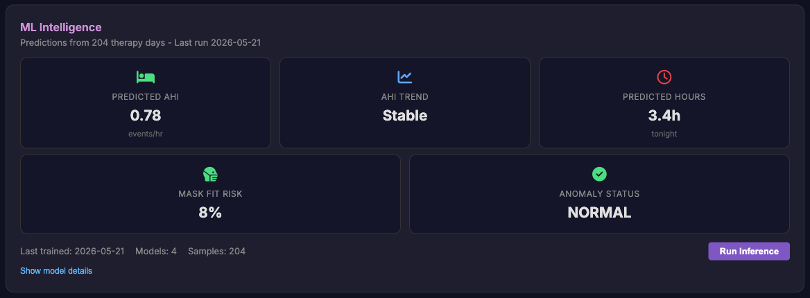 ML Intelligence: predicted AHI, trend, and anomaly status learned from your own nights