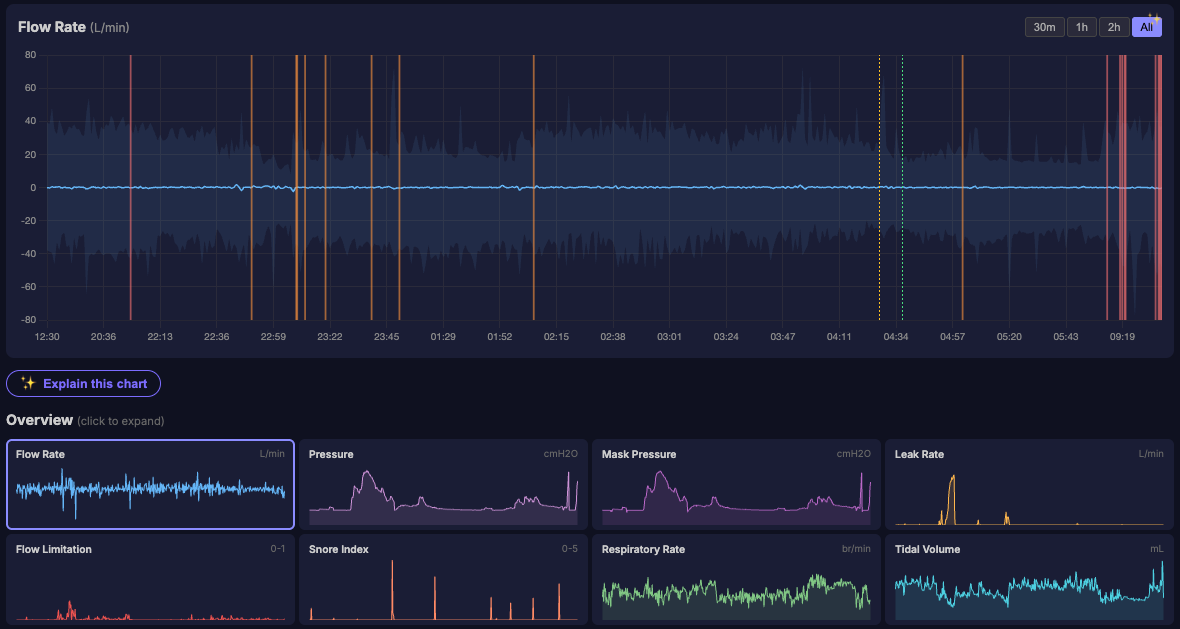 A full night from Sleep Bridge Cloud, charted in CpapDash